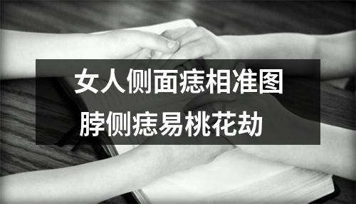<h3>女人侧面痣相准图脖侧痣易桃花劫