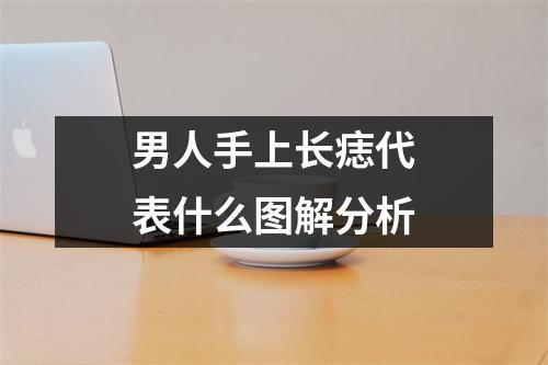 <h3>男人手上长痣代表什么图解分析