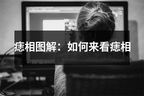 痣相图解：如何来看痣相