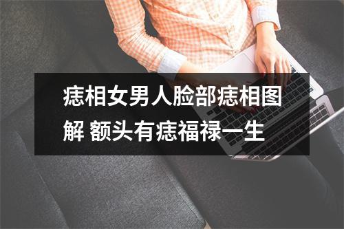 <h3>痣相女男人脸部痣相图解额头有痣福禄一生