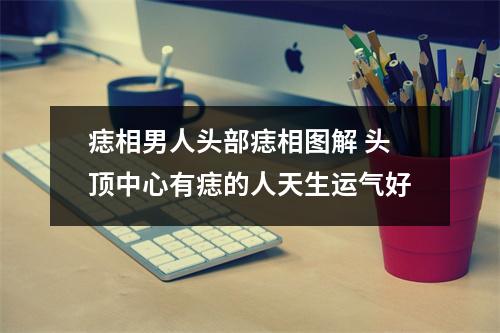 <h3>痣相男人头部痣相图解头顶中心有痣的人天生运气好