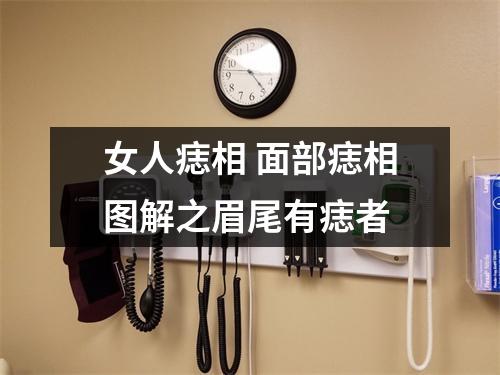 女人痣相面部痣相图解之眉尾有痣者