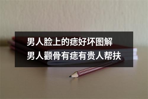 <h3>男人脸上的痣好坏图解男人颧骨有痣有贵人帮扶