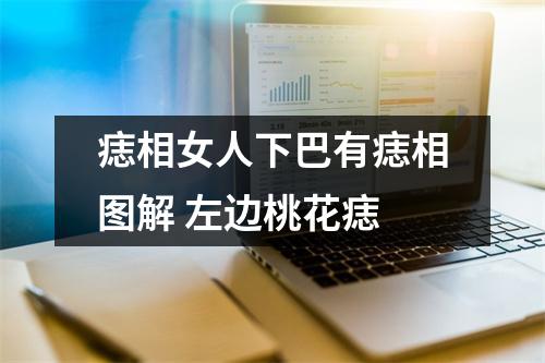 <h3>痣相女人下巴有痣相图解左边桃花痣