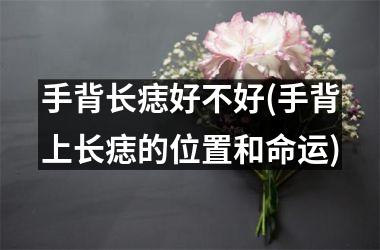 <h3>手背长痣好不好(手背上长痣的位置和命运)