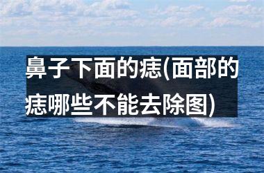 <h3>鼻子下面的痣(面部的痣哪些不能去除图)