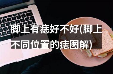 <h3>脚上有痣好不好(脚上不同位置的痣图解)