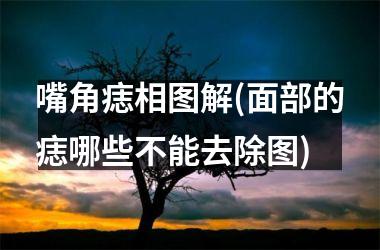 嘴角痣相图解(面部的痣哪些不能去除图)