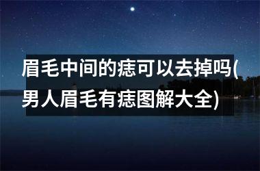 <h3>眉毛中间的痣可以去掉吗(男人眉毛有痣图解大全)