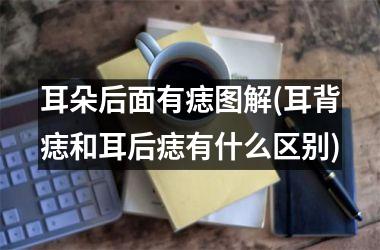<h3>耳朵后面有痣图解(耳背痣和耳后痣有什么区别)