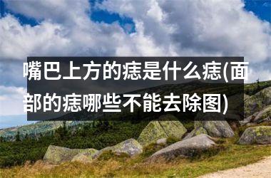 <h3>嘴巴上方的痣是什么痣(面部的痣哪些不能去除图)