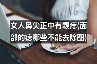 女人鼻尖正中有颗痣(面部的痣哪些不能去除图)