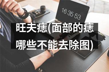 旺夫痣(面部的痣哪些不能去除图)