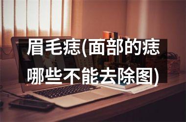 眉毛痣(面部的痣哪些不能去除图)