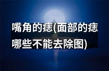 嘴角的痣(面部的痣哪些不能去除图)