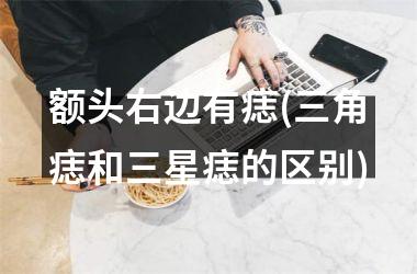 <h3>额头右边有痣(三角痣和三星痣的区别)