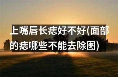上嘴唇长痣好不好(面部的痣哪些不能去除图)