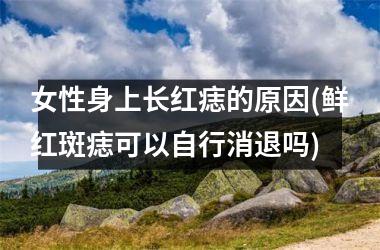 女性身上长红痣的原因(鲜红斑痣可以自行消退吗)