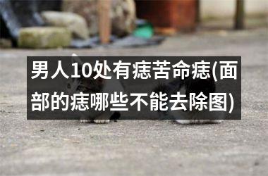 男人10处有痣苦命痣(面部的痣哪些不能去除图)