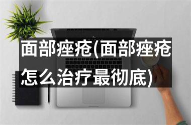 <h3>面部痤疮(面部痤疮怎么治疗最彻底)