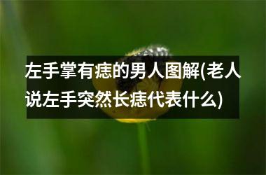 左手掌有痣的男人图解(老人说左手突然长痣代表什么)