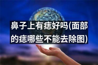 鼻子上有痣好吗(面部的痣哪些不能去除图)