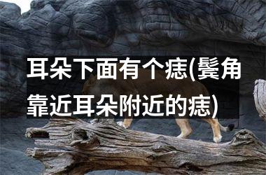 <h3>耳朵下面有个痣(鬓角靠近耳朵附近的痣)