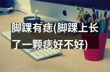 脚踝有痣(脚踝上长了一颗痣好不好)