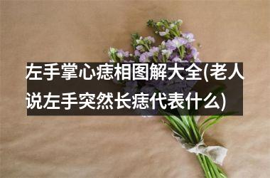 左手掌心痣相图解大全(老人说左手突然长痣代表什么)