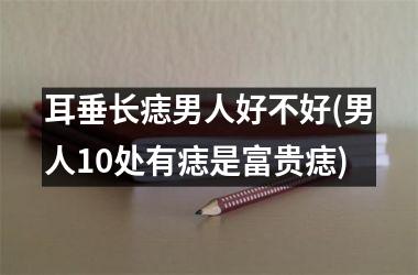 <h3>耳垂长痣男人好不好(男人10处有痣是富贵痣)