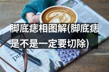 脚底痣相图解(脚底痣是不是一定要切除)