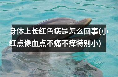 <h3>身体上长红色痣是怎么回事(小红点像血点不痛不痒特别小)