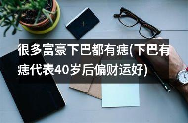 <h3>很多富豪下巴都有痣(下巴有痣代表40岁后偏财运好)