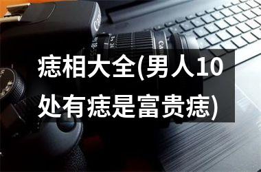 痣相大全(男人10处有痣是富贵痣)