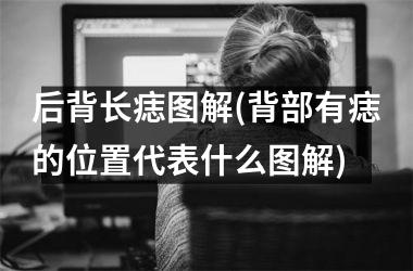后背长痣图解(背部有痣的位置代表什么图解)