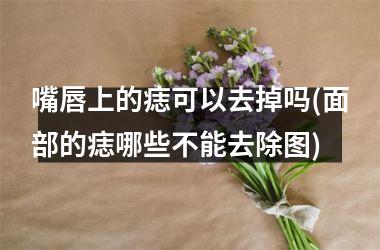 嘴唇上的痣可以去掉吗(面部的痣哪些不能去除图)