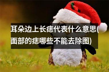 耳朵边上长痣代表什么意思(面部的痣哪些不能去除图)