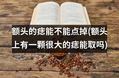 额头的痣能不能点掉(额头上有一颗很大的痣能取吗)