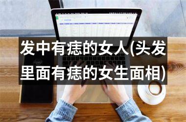 <h3>发中有痣的女人(头发里面有痣的女生面相)