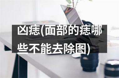 凶痣(面部的痣哪些不能去除图)