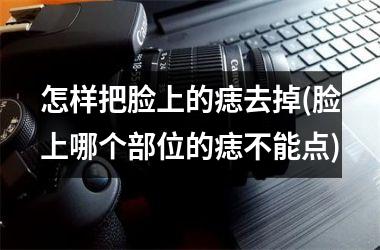 怎样把脸上的痣去掉(脸上哪个部位的痣不能点)