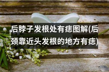 后脖子发根处有痣图解(后颈靠近头发根的地方有痣)