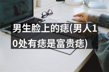 <h3>男生脸上的痣(男人10处有痣是富贵痣)