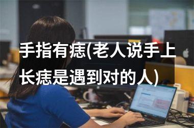 <h3>手指有痣(老人说手上长痣是遇到对的人)