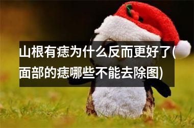 <h3>山根有痣为什么反而更好了(面部的痣哪些不能去除图)