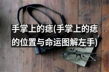 手掌上的痣(手掌上的痣的位置与命运图解左手)