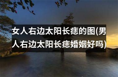 女人右边太阳长痣的图(男人右边太阳长痣婚姻好吗)
