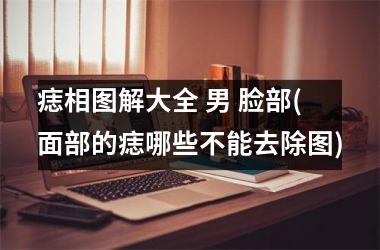 痣相图解大全 男 脸部(面部的痣哪些不能去除图)