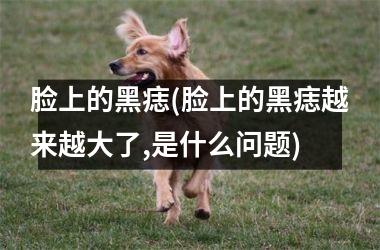 <h3>脸上的黑痣(脸上的黑痣越来越大了,是什么问题)