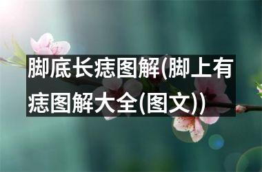 脚底长痣图解(脚上有痣图解大全(图文))